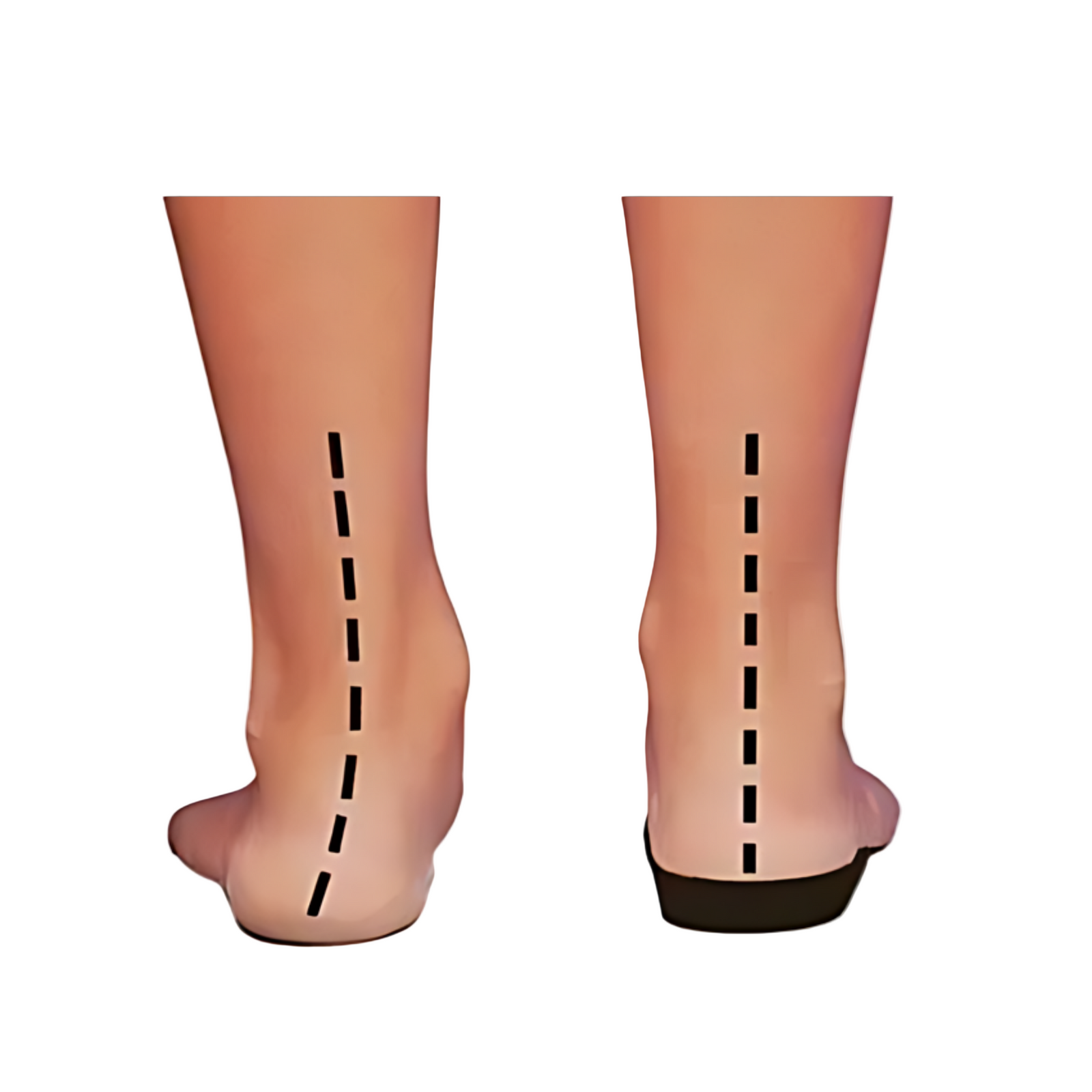 Kvinners Sneakers med Orthopedisk Støtte og Støtdempende Såle 2