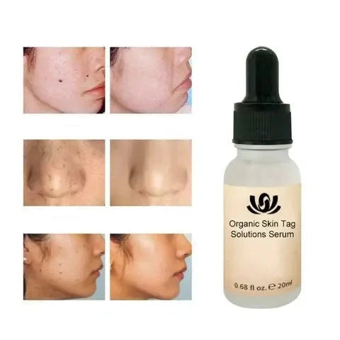 Spotfritt organisk rensende serum