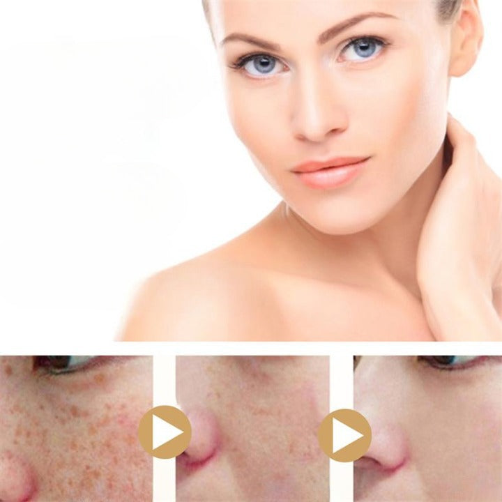 Gurkemeie Dark Spot Whitening Serum