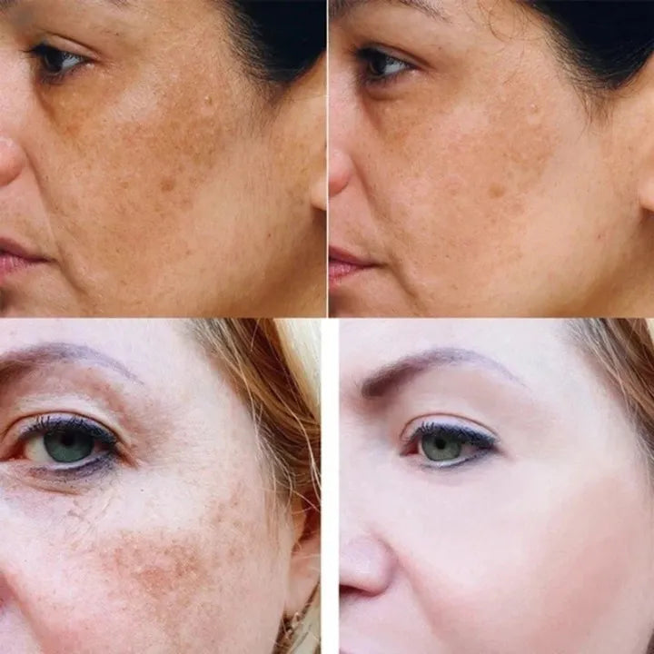 Gurkemeie Dark Spot Whitening Serum